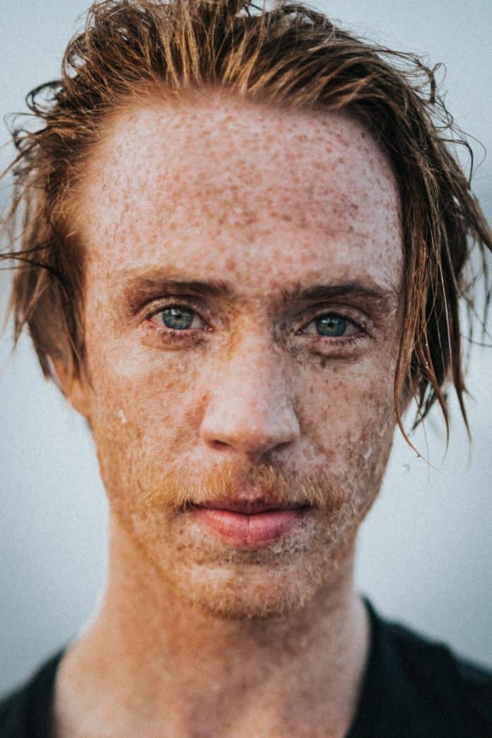 Red-headed man with freckles